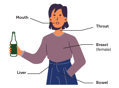 Person's upper body with cancer labelled: mouth, throat, breast (female) liver and bowel